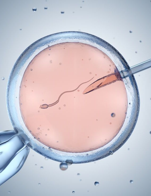 Artificial insemination — microscopic view of fertilisation procedure